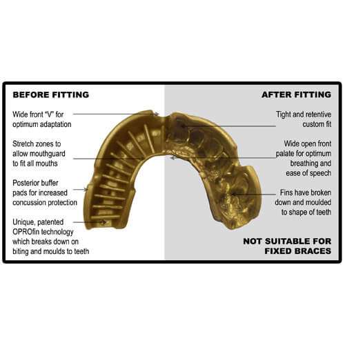OPROshield JUNIOR Mouthguard - Image 3